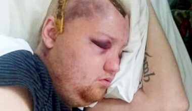 David Bown, 41, claims delays in an MRI scan would have highlighted life-threatening complications that has left him relying him on his parents for care