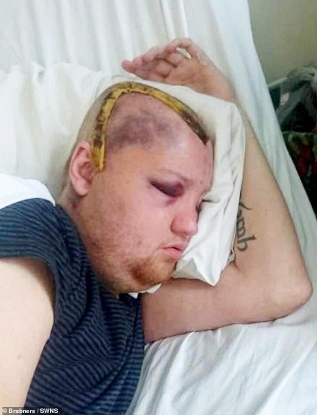 David Bown, 41, claims delays in an MRI scan would have highlighted life-threatening complications that has left him relying him on his parents for care