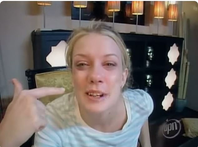 Snaggle-toothed Joanie Dodds just before sitting in the dentist’s chair to get her smile fixed so she could stay in the competition