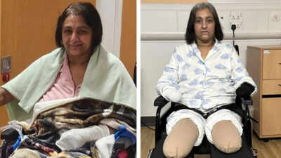 Indian-origin woman in England loses all four limbs after dog lick leads to sepsis: 'How did this happen in 24 hours?'
