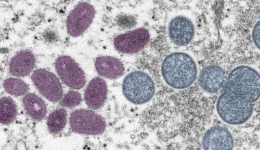 New recombinant mpox strain detected in UK and India, WHO urges continued monitoring