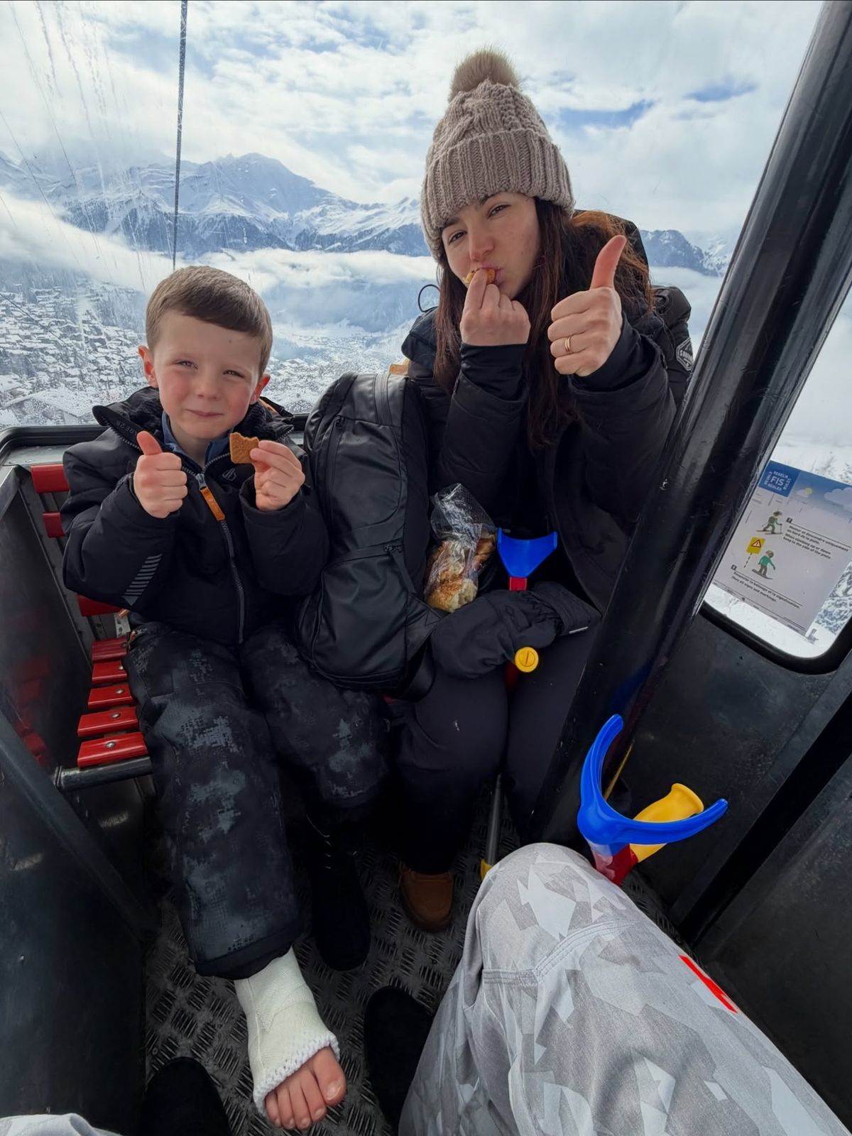 Morsia Morisa with a thumbs up and bandaged leg visible
