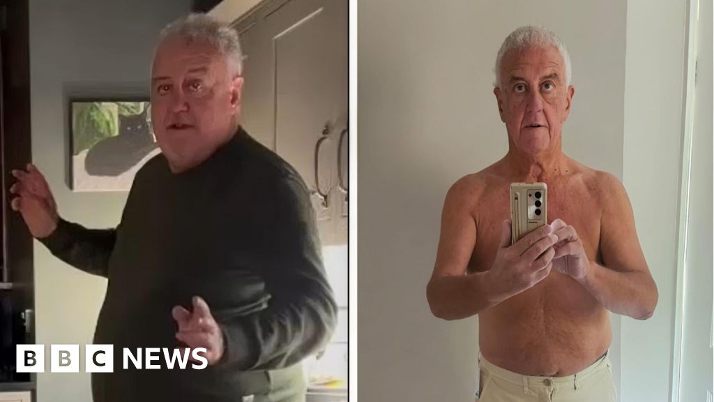 Mounjaro availability a postcode lottery, says Stone patient - BBC