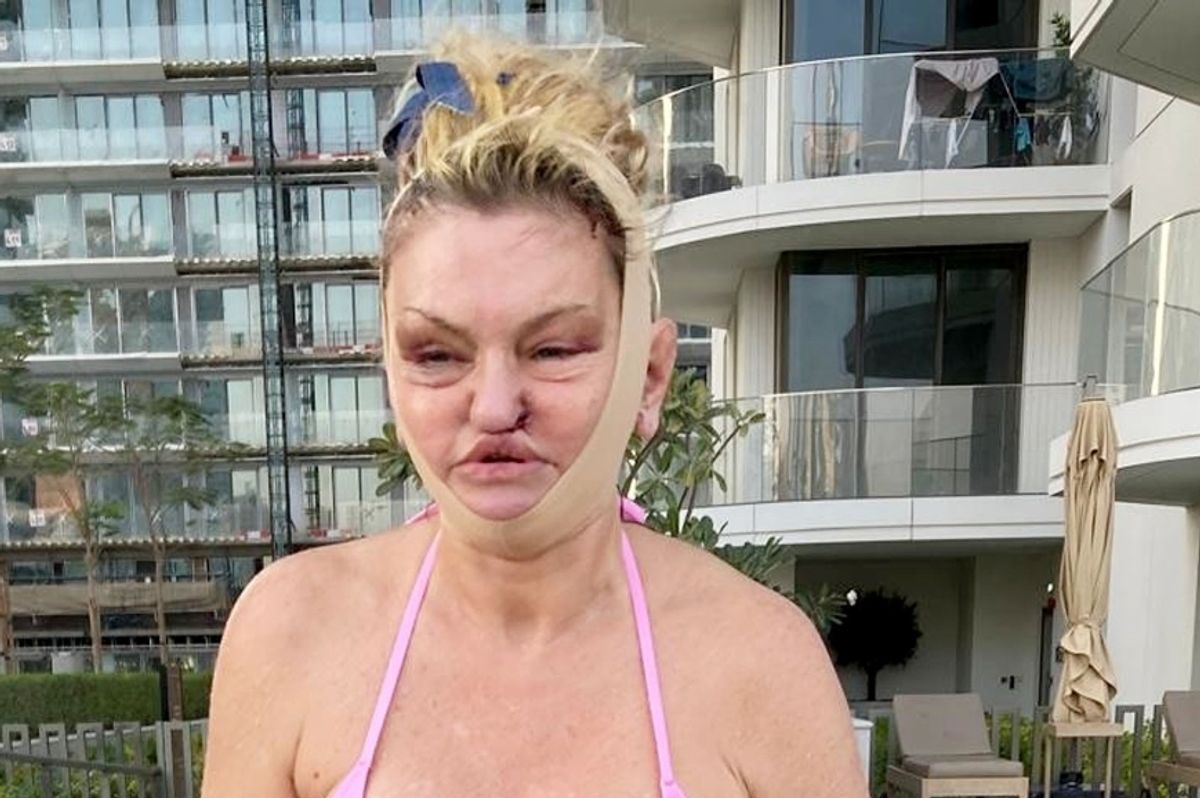 Danniella showed off her new face