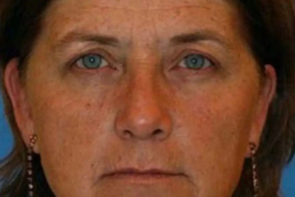 The twin who smoked (pictured) showed tell-tale signs