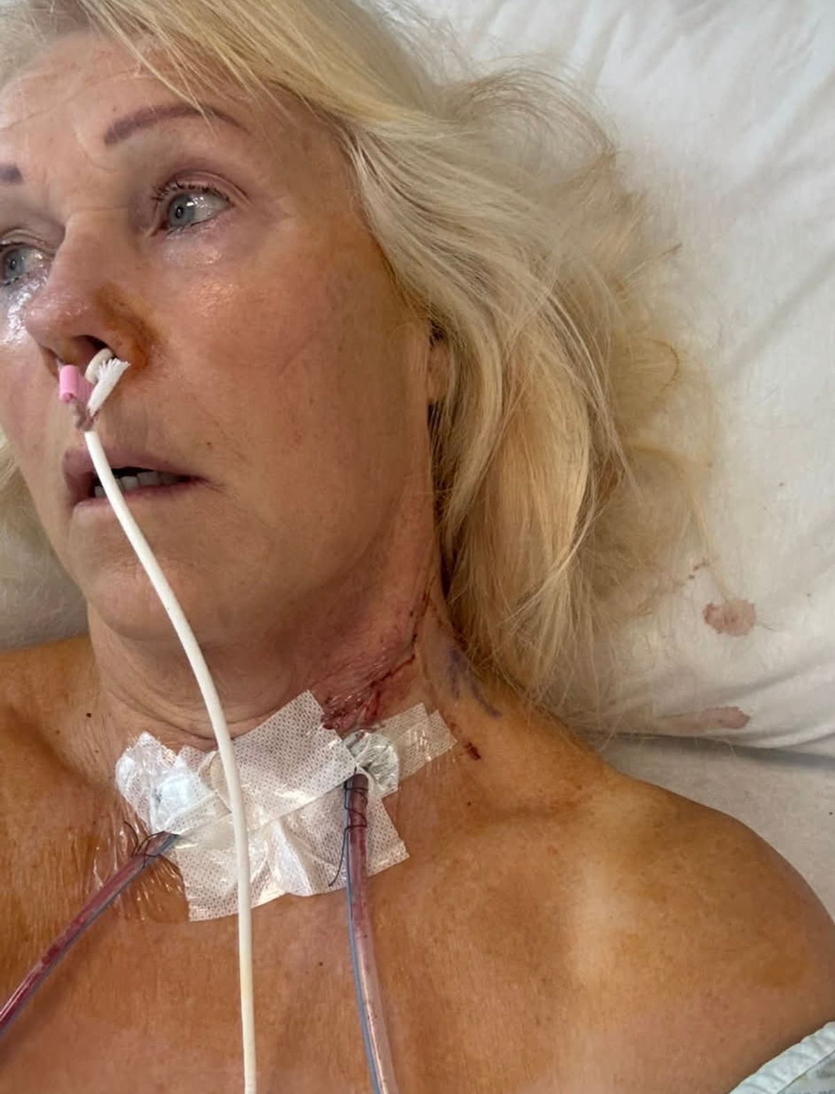 Margot in hospital for radiotherapy.