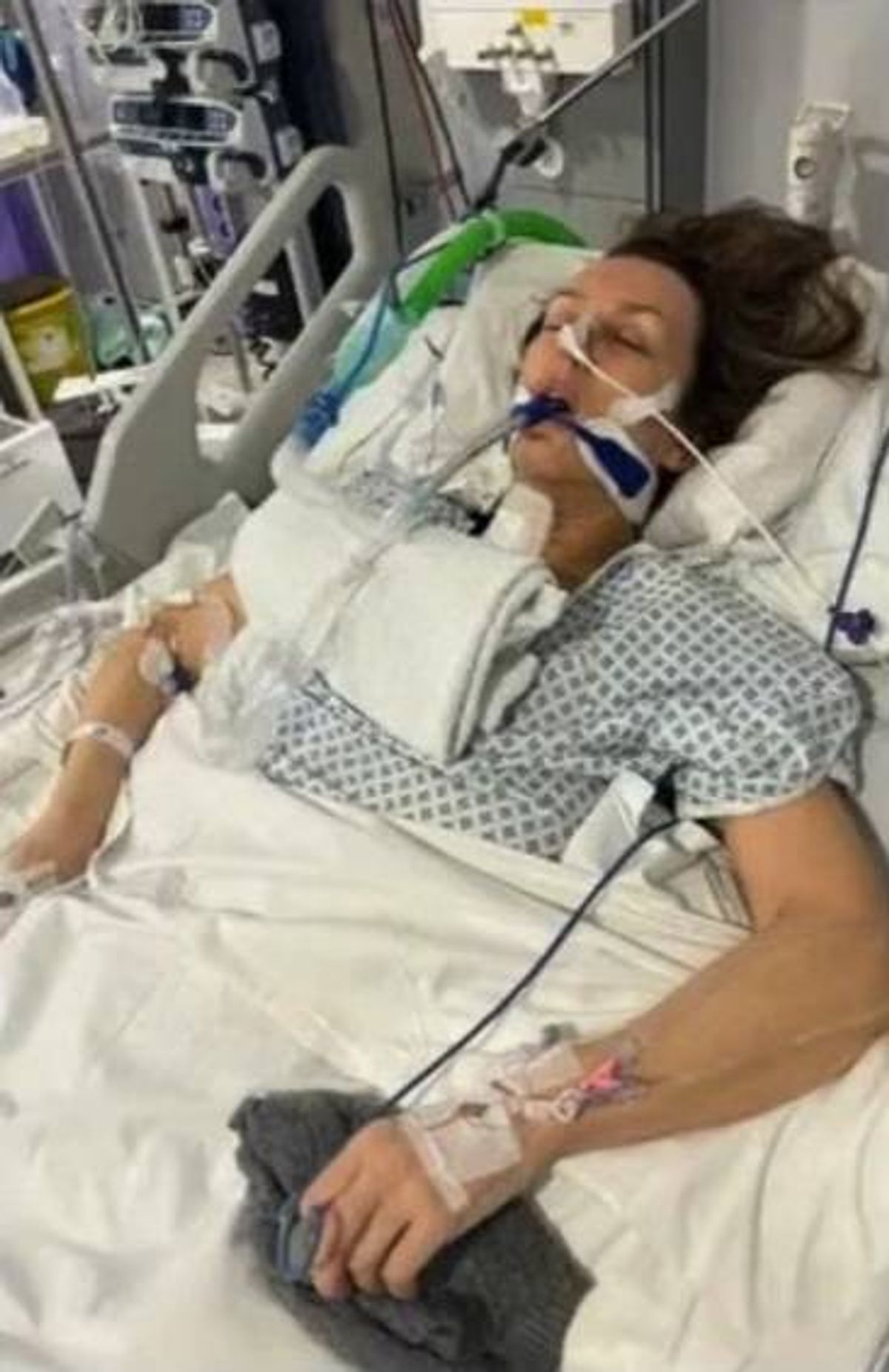 Trudi Burgess in hospital following Easom's violent assault that left her paralysed