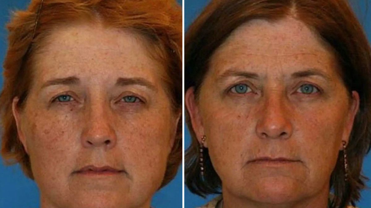 Side by side of twins (L is the non smoker) showing physical changes.