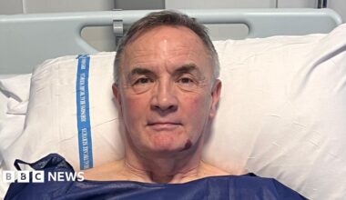 Michael Robinson is in a hospital bed. He is wearing blue patient scrubs and has short white hair. He is resting his head up on a pillow.