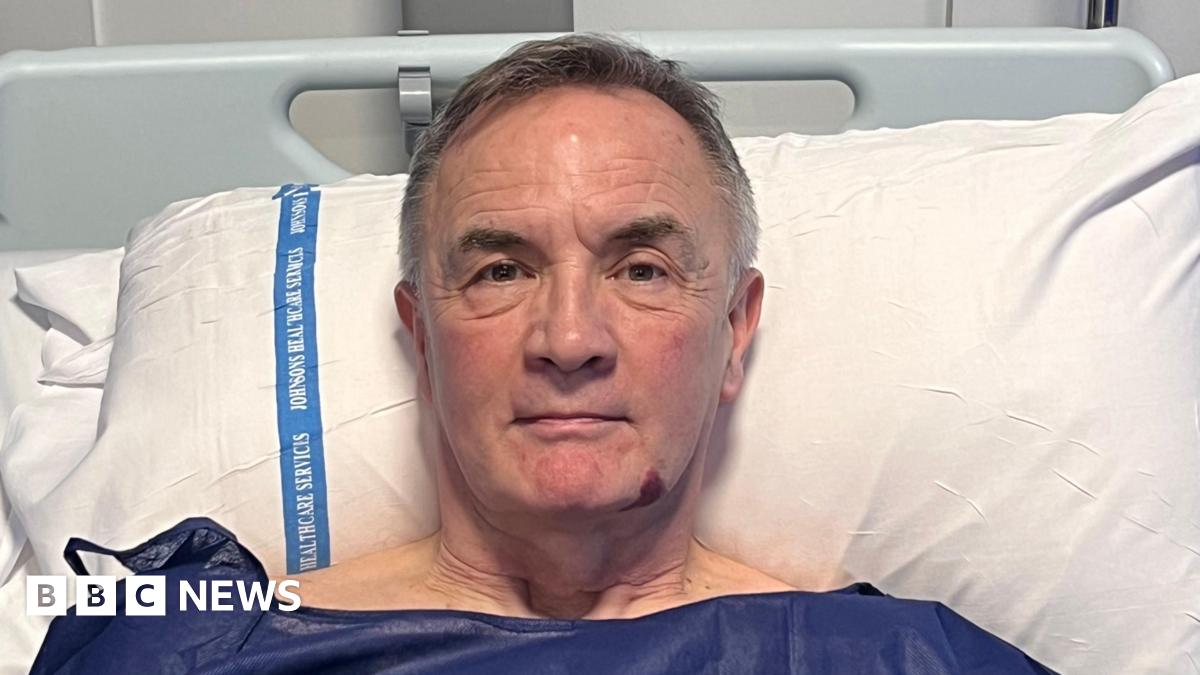 Michael Robinson is in a hospital bed. He is wearing blue patient scrubs and has short white hair. He is resting his head up on a pillow.