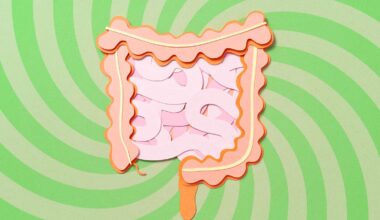 4 Supplements to Avoid If You Have Ulcerative Colitis