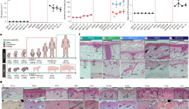 Rete ridges form via evolutionarily distinct mechanisms in mammalian skin