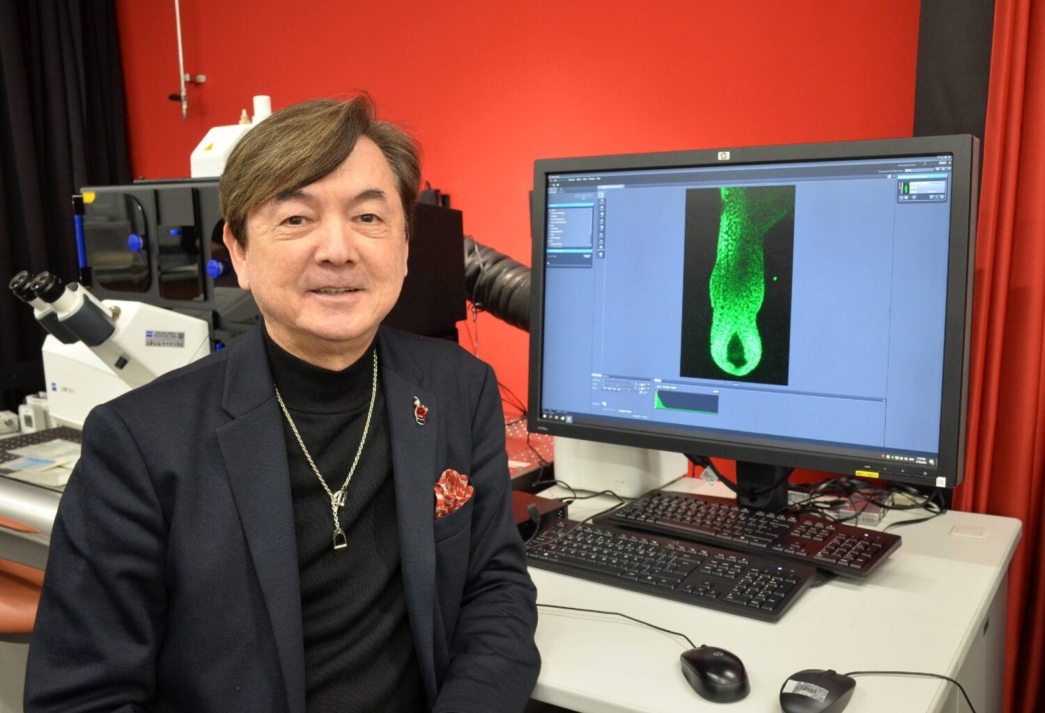 Japan-led cell discovery hints at potential new treatments for hair loss