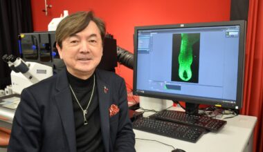 Japan-led cell discovery hints at potential new treatments for hair loss