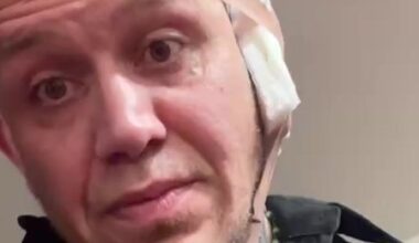 MMA fighter who got his ear chewed off a la Tyson-Holyfield posts grisly recovery pics (NSFW)