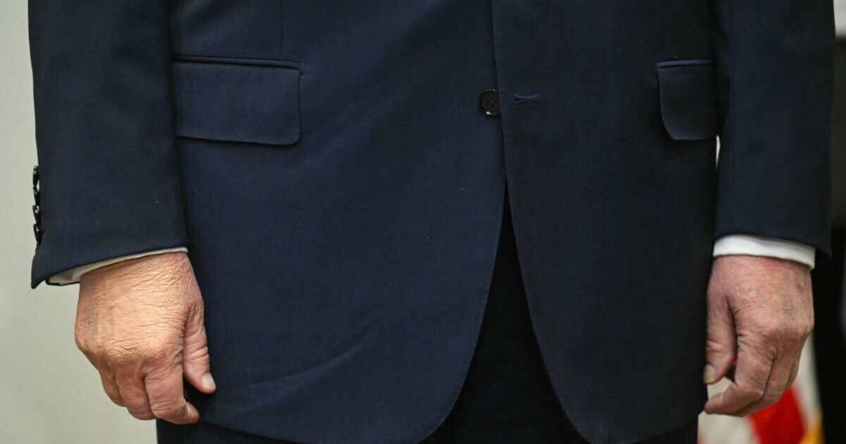 Trump's bruised hand now 'swollen' as health fears soar | World | News