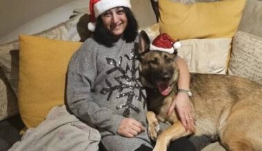 Woman loses four limbs after dog lick infection causes sepsis horror | UK | News