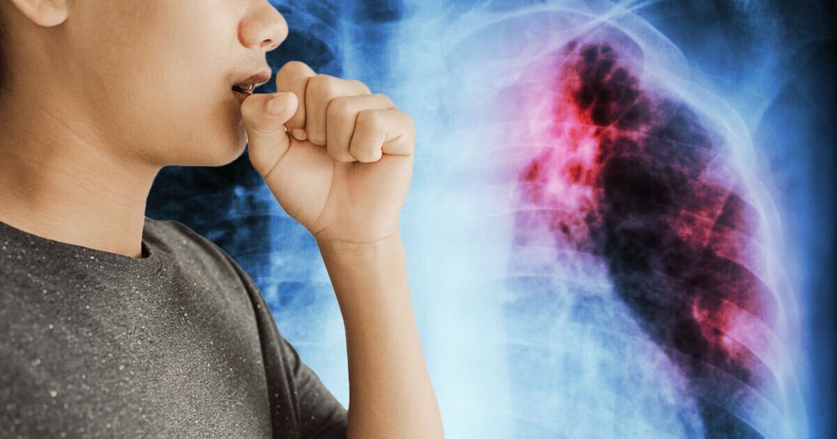 This is the truth about the Victorian disease that never went away