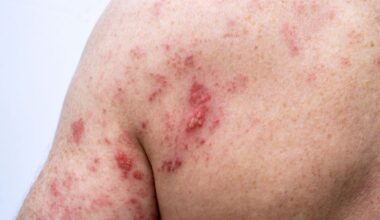 Urgent vaccine warning issued to millions of over 65s | UK | News