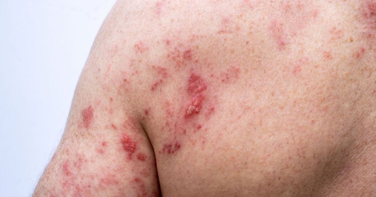 Urgent vaccine warning issued to millions of over 65s | UK | News