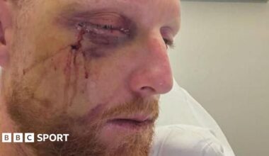 A photo of England Test captain Ben Stokes following surgery
