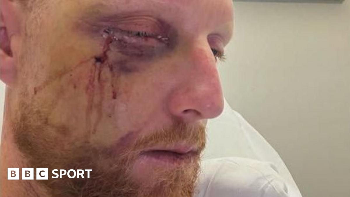 A photo of England Test captain Ben Stokes following surgery