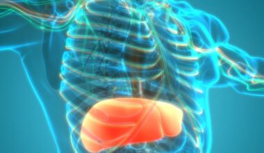 People from northwest Ireland most likely to develop ‘Celtic Curse’ genetic disease, study finds – The Irish Times