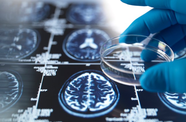 A gloved hand holding a petri dish, over a brain MRI scan.