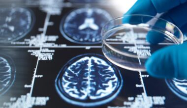 A world where dementia no longer devastates lives is 'finally within reach'