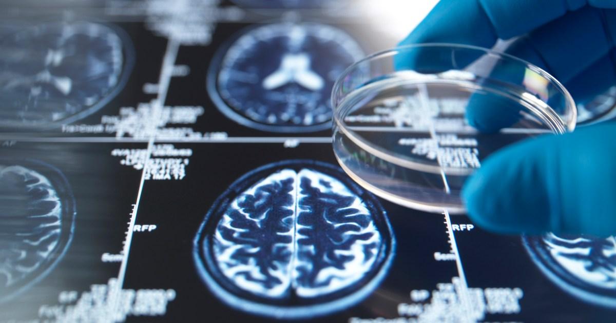 A world where dementia no longer devastates lives is 'finally within reach'