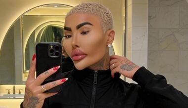 Hammond in Overwatch