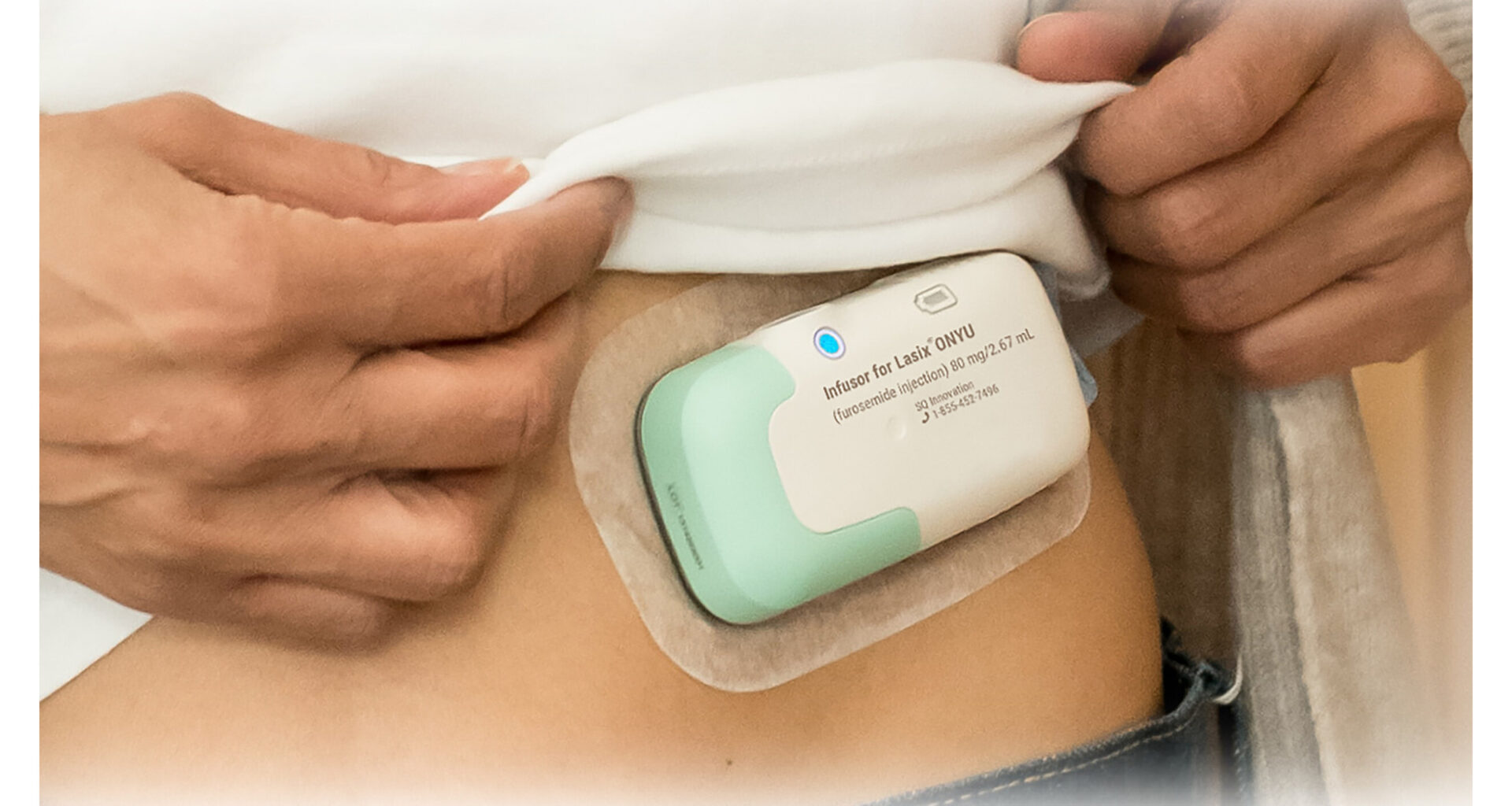 SQ Innovation's Lasix® ONYU Now Available for Order Through Major U.S. Pharmaceutical Distributors