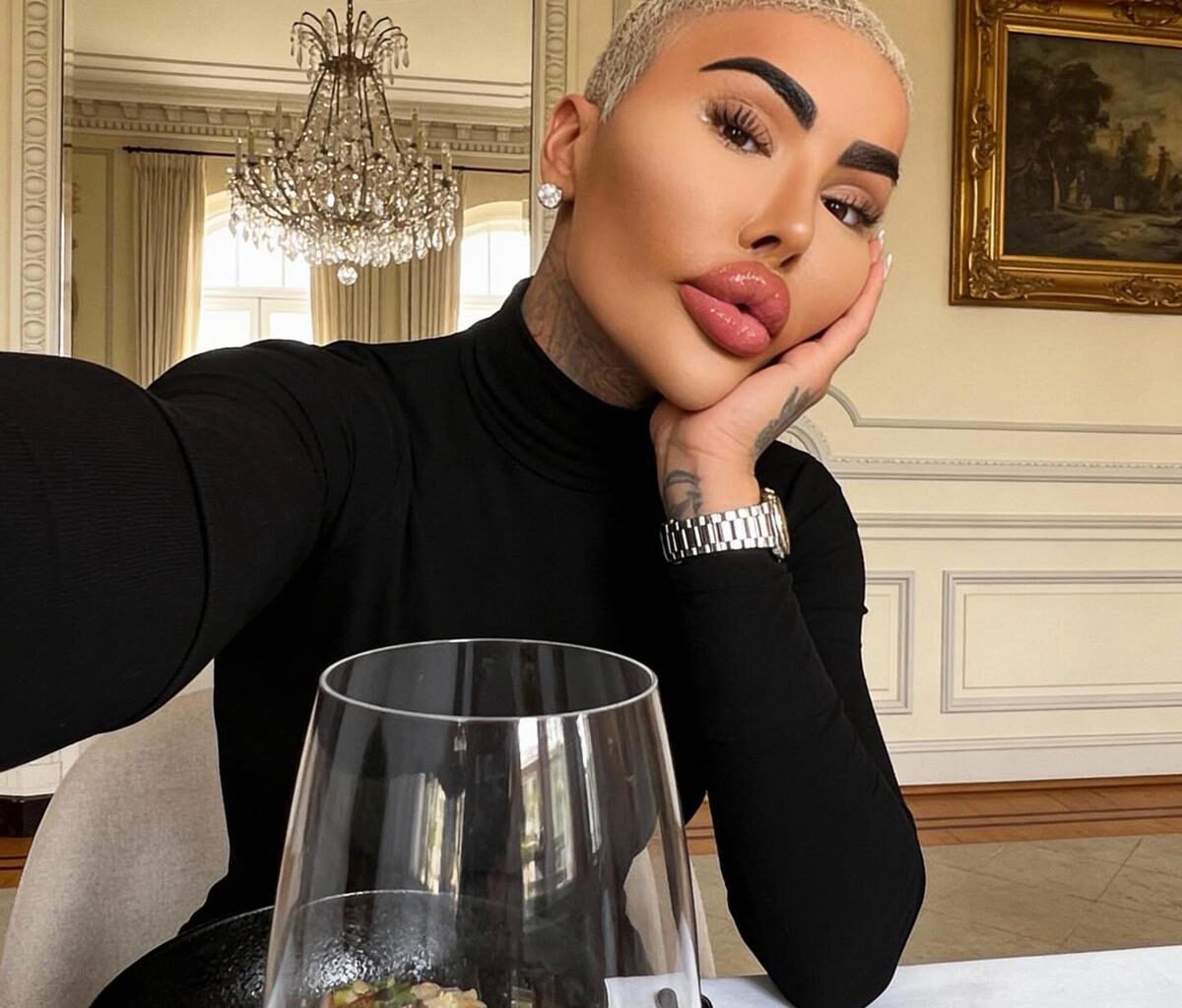 Two arrested after ‘Lip King’ dies 'following cosmetic surgery' - London Evening Standard