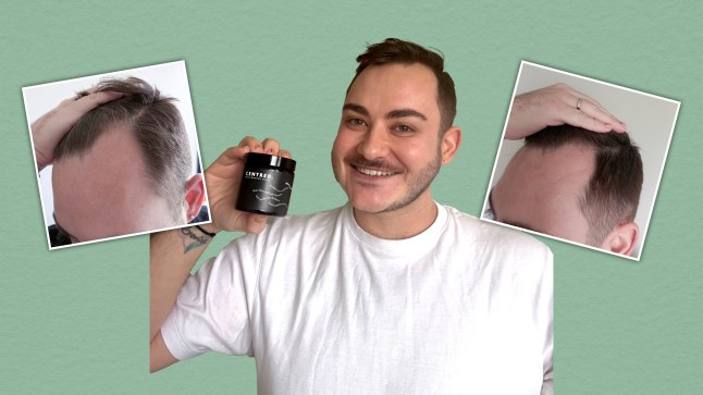 Male holds Centred Tender Love and Hair - Men's Hair Vitamins - along with before and after images