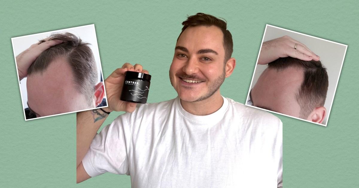 I’ve suffered from thinning hair - this Centred supplement has brought it back to life