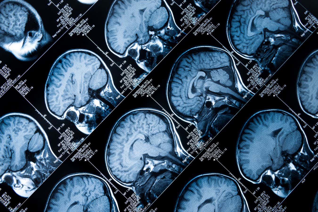 New Scientist. Science news and long reads from expert journalists, covering developments in science, technology, health and the environment on the website and the magazine.