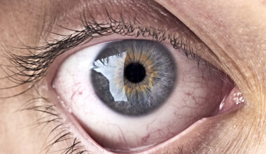 Bacteria at The Back of Your Eye May Be Linked With Alzheimer's Progress : ScienceAlert