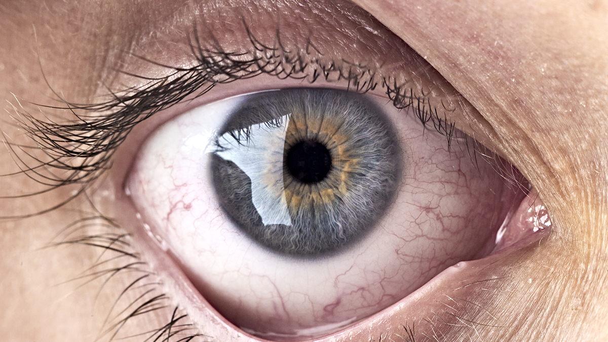 Bacteria at The Back of Your Eye May Be Linked With Alzheimer's Progress : ScienceAlert
