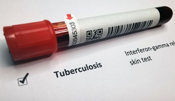 Tuberculosis blood test