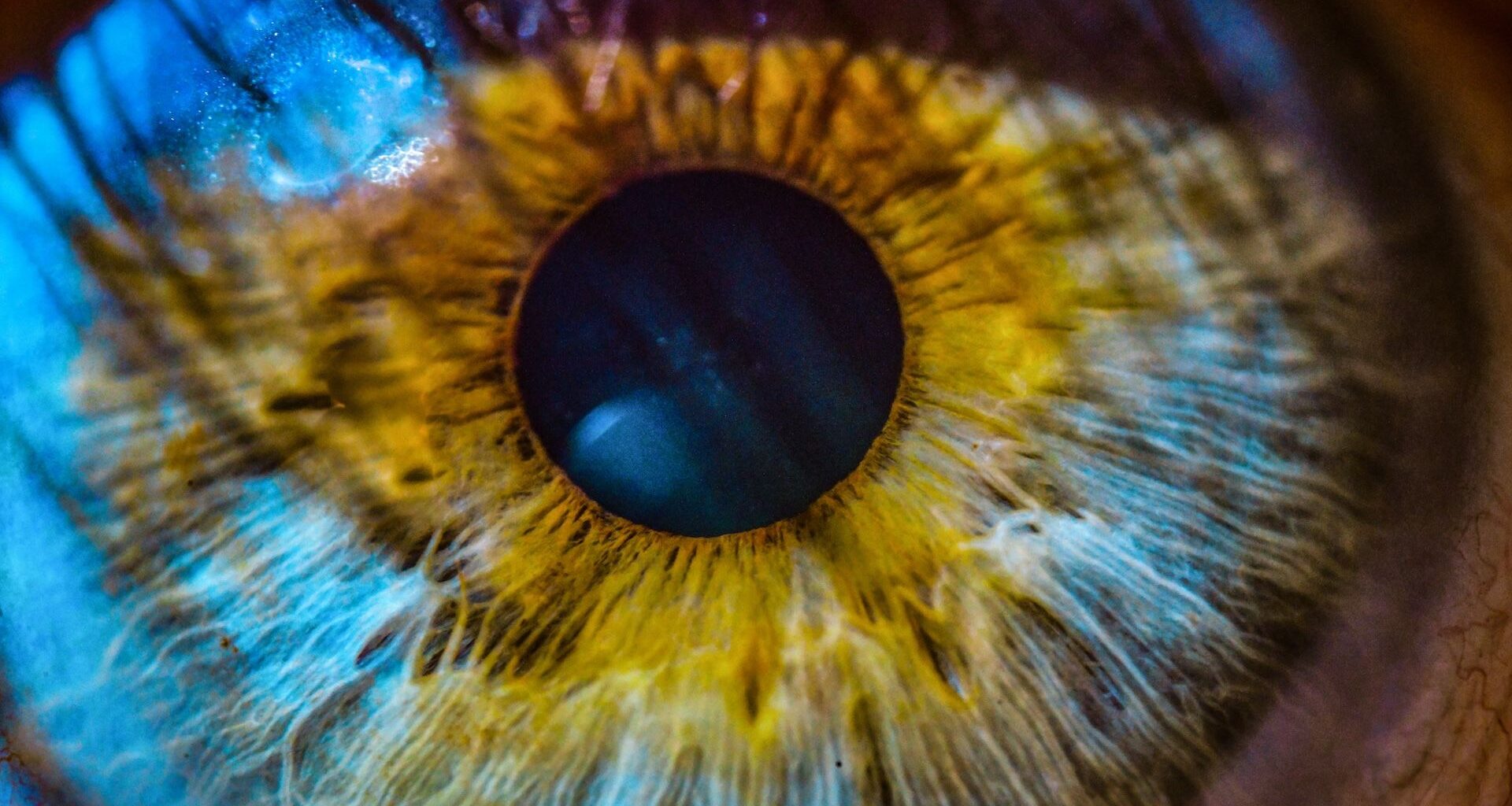 closeup of blue iris of eye, with pupil and yellow striations