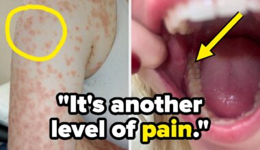 21 Hard Truths About Living With "Minor" Medical Issues