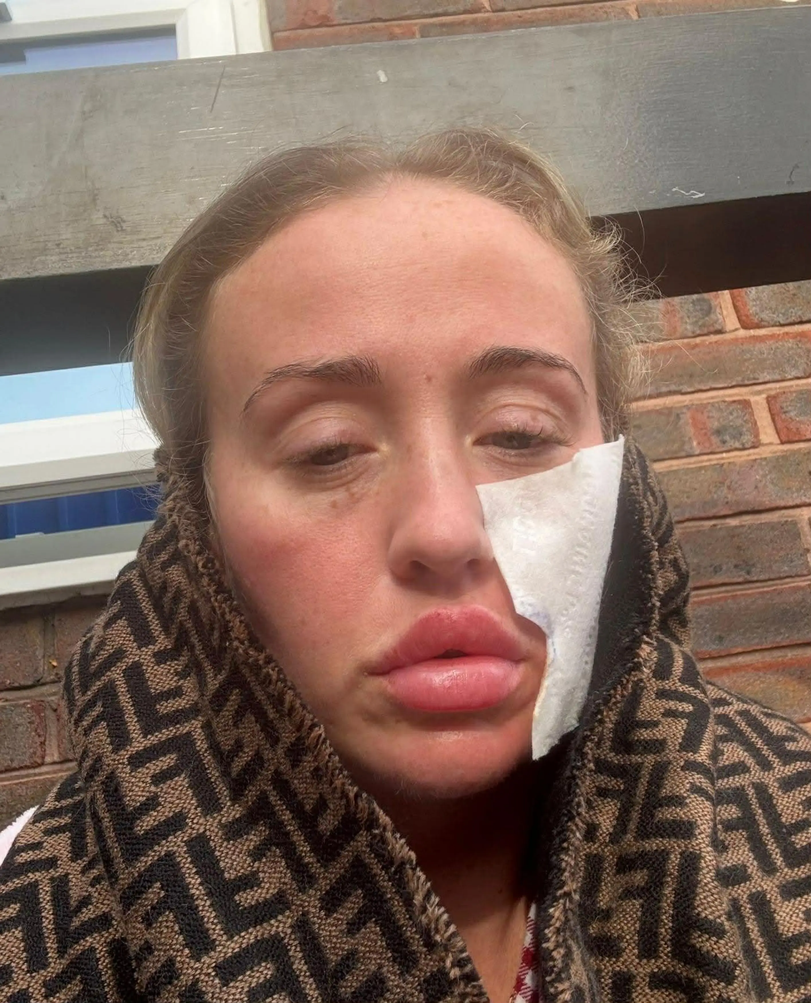 She says the cold weather makes the condition worse. (Kennedy News and Media)