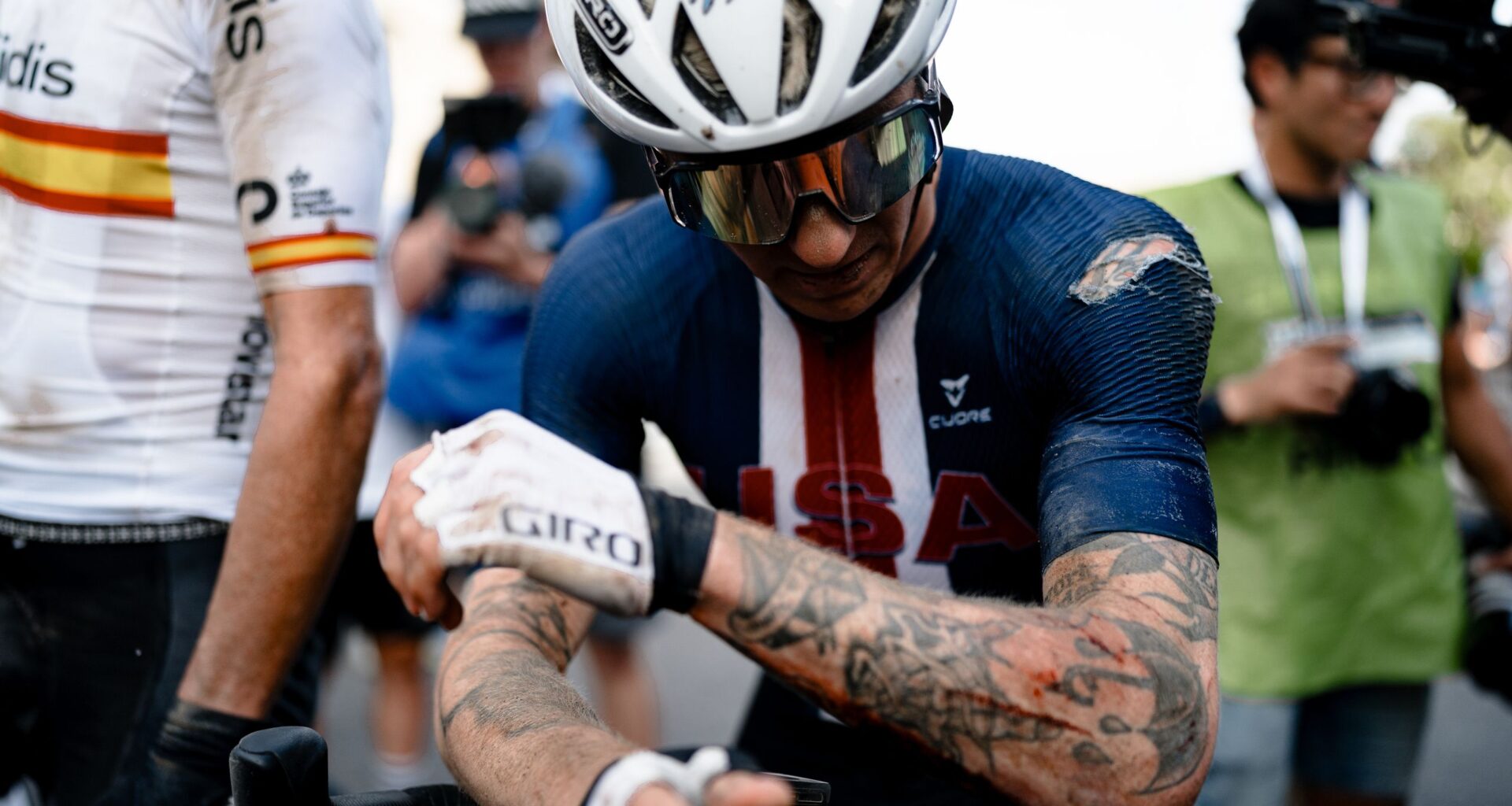 Keegan Swenson breaks pelvis after 'getting smoked by car door'