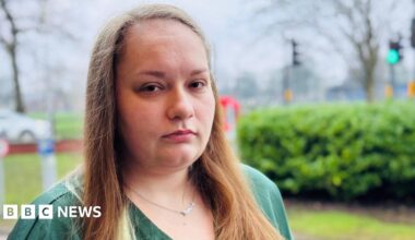 Georgia's wrist, which appears to have been recently operated on. It appears to be resting on a hospital bed. It shows a large scar and evidence of stitches and dried blood.