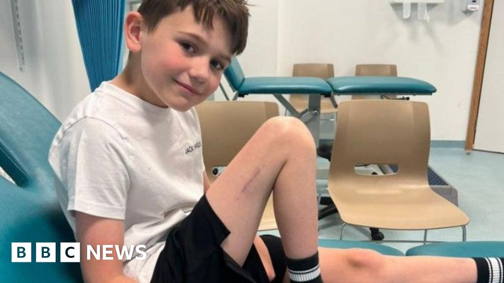 Alder Hey pioneers treatment to make boy taller - BBC