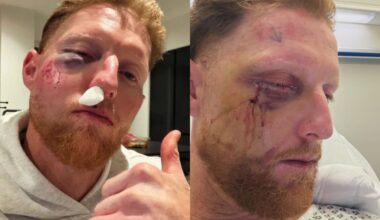 Ben Stokes Shares Surgery Update With Hilarious Instagram Story, Set To Miss PSL 2026