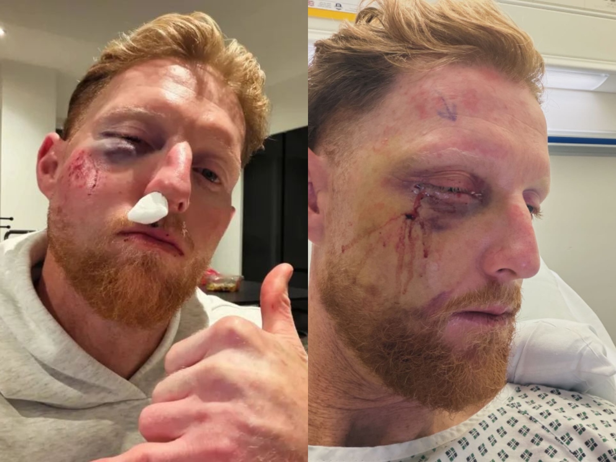 Ben Stokes Shares Surgery Update With Hilarious Instagram Story, Set To Miss PSL 2026