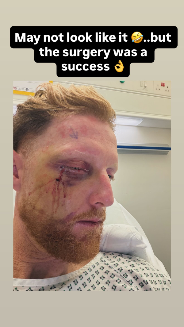 BEN STOKES SURGERY UPDATE INSTAGRAM STORY BEN STOKES SURGERY UPDATE INSTAGRAM STORY