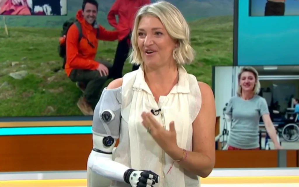 British woman claims she’s 80% human and 20% robot thanks to a mind-reading bionic arm