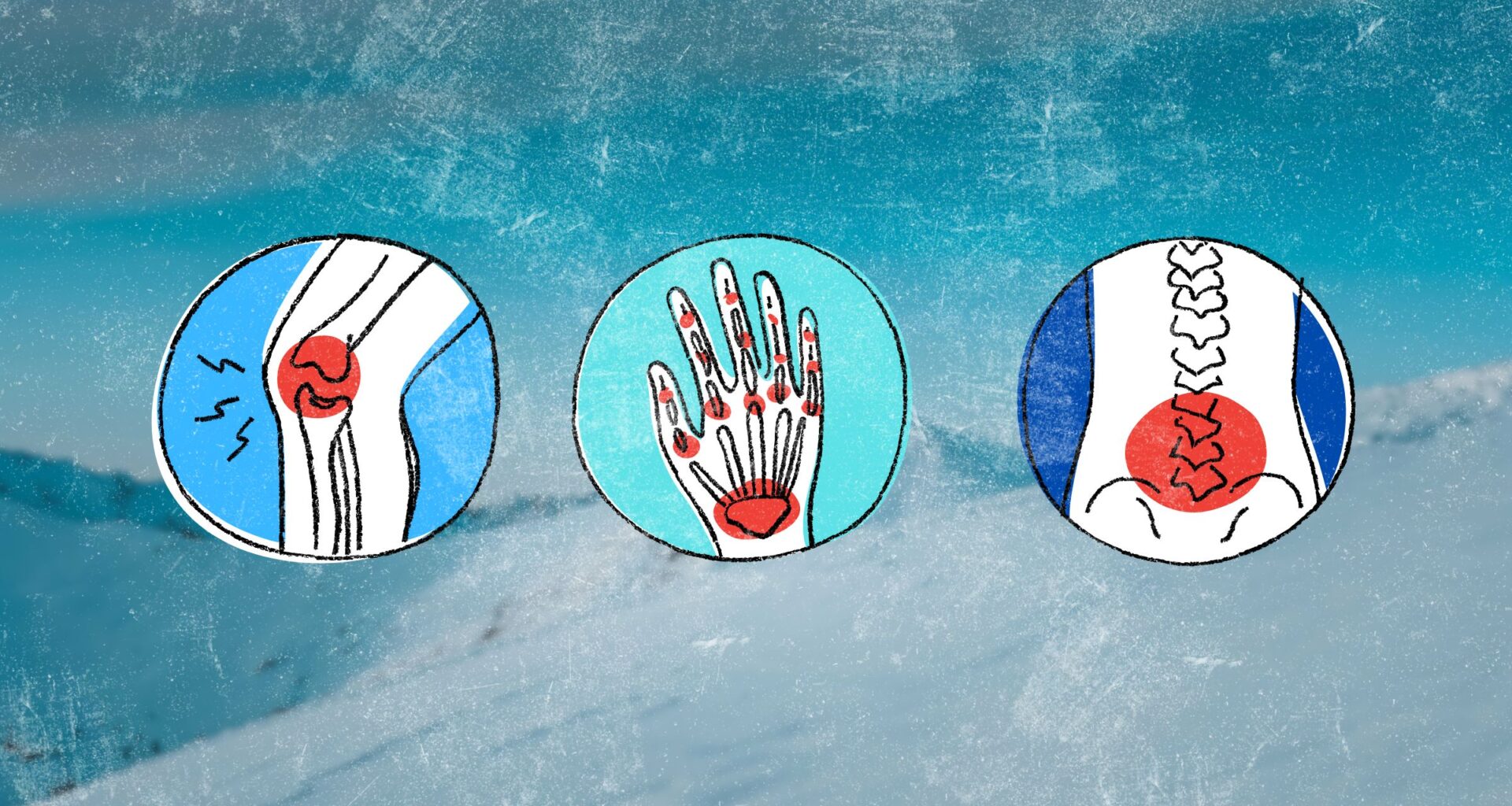 sore muscles and joints in cold weather